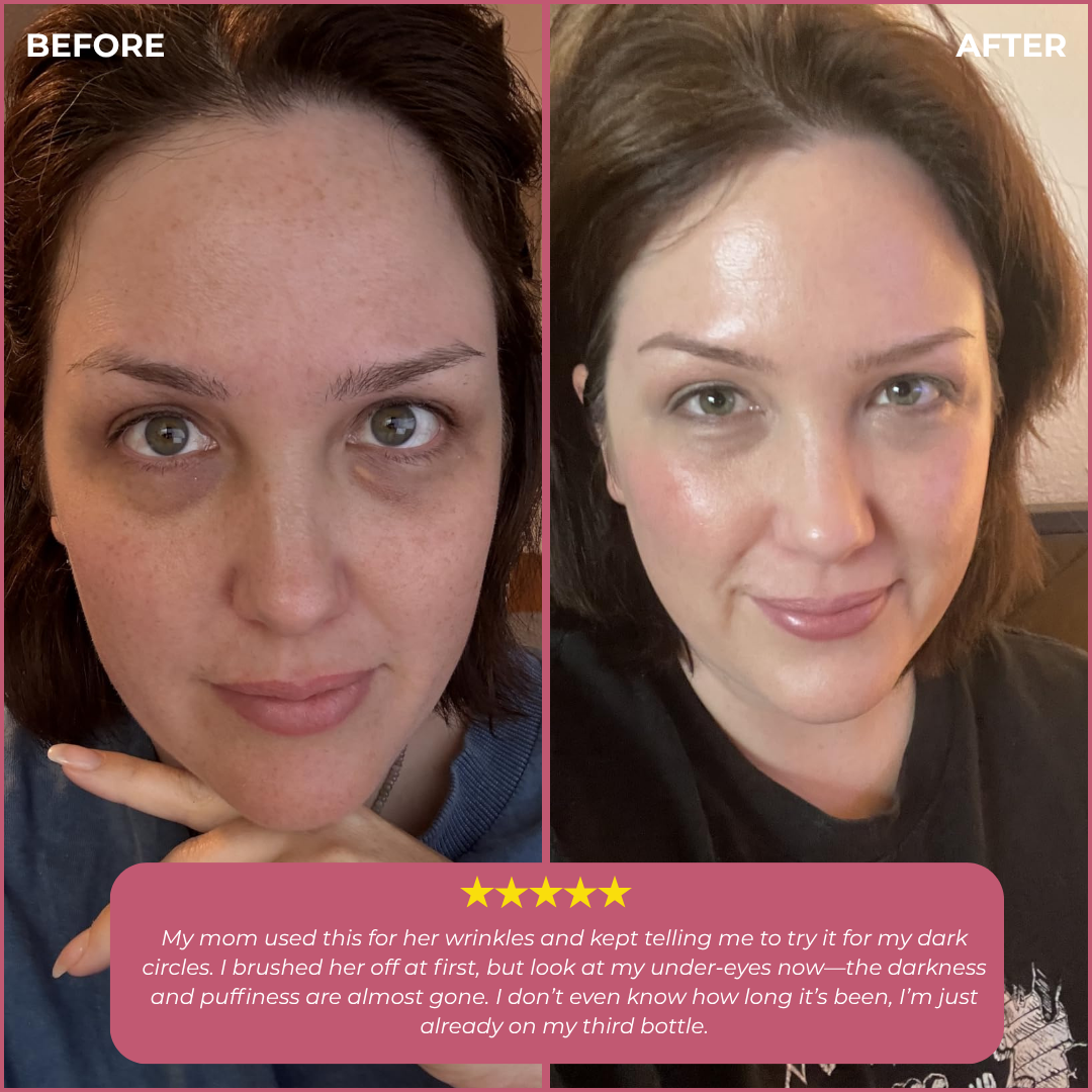 Korean Silk Thread Lift Peptide Serum – Instant Lift, Deep Volume, Youthful Contours