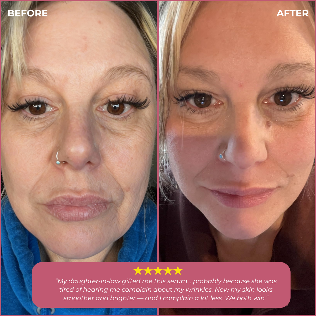 Korean Silk Thread Lift Peptide Serum – Instant Lift, Deep Volume, Youthful Contours