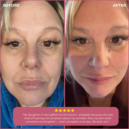 Korean Silk Thread Lift Peptide Serum – Instant Lift, Deep Volume, Youthful Contours