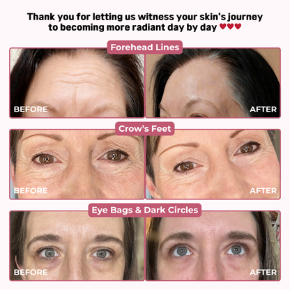 Korean Silk Thread Lift Peptide Serum – Instant Lift, Deep Volume, Youthful Contours